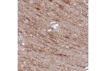Immunohistochemical staining of human cerebral cortex shows distinct cytoplasmic positivity in subsets of neuronal cells.