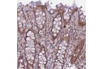 Immunohistochemical staining of human rectum shows moderate cytoplasmic and nuclear positivity in glandular cells.