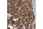 Immunohistochemical staining of human pancreas shows strong cytoplasmic positivity in exocrine glandular cells.