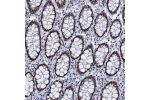 Immunohistochemical staining of human hippocampus shows strong nuclear positivity in neuronal cells.