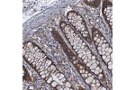 Immunohistochemical staining of human rectum shows moderate cytoplasmic and nuclear positivity in glandular cells.