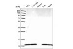 Western blot analysis in human cell line RT-4, human cell line U-251 MG, human plasma, human liver tissue and human tonsil tissue.