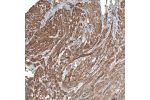 Immunohistochemical staining of human smooth muscle shows moderate positivity.