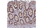 Immunohistochemical staining of human colon shows moderate dot-like nuclear and cytoplasmic positivity in glandular cells.