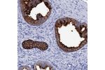 Immunohistochemical staining of human prostate shows strong cytoplasmic positivity in glandular cells.
