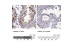 Immunohistochemistry analysis in human testis and prostate tissues using HPA040025 antibody. Corresponding HMMR RNA-seq data are presented for the same tissues.