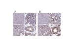 Immunohistochemical staining of human cerebral cortex, endometrium, kidney and testis using Anti-MPHOSPH8 antibody HPA040035 (A) shows similar protein distribution across tissues to independent antibody HPA039701 (B).