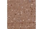 Immunohistochemical staining of human cerebral cortex shows strong granular cytoplasmic positivity in neurons.