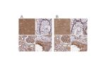 Immunohistochemical staining of human cerebral cortex, colon, kidney and testis using Anti-DCTN2 antibody HPA040040 (A) shows similar protein distribution across tissues to independent antibody HPA039715 (B).