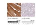 Immunohistochemistry analysis in human skeletal muscle and pancreas tissues using Anti-CAPN3 antibody. Corresponding CAPN3 RNA-seq data are presented for the same tissues.