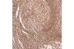Immunohistochemical staining of human testis shows strong granular cytoplasmic positivity in Leydig cells.