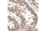 Immunohistochemical staining of human testis shows strong nuclear positivity in cells in seminiferous ducts.
