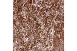 Immunohistochemical staining of human adrenal gland shows strong cytoplasmic positivity in glandular cells.