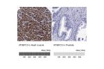 Immunohistochemistry analysis in human heart muscle and prostate tissues using HPA040147 antibody. Corresponding MYBPC3 RNA-seq data are presented for the same tissues.