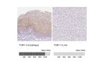 Immunohistochemistry analysis in human esophagus and colon tissues using HPA040171 antibody. Corresponding TGM1 RNA-seq data are presented for the same tissues.