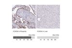 Immunohistochemistry analysis in human placenta and liver tissues using HPA040232 antibody. Corresponding FOXO4 RNA-seq data are presented for the same tissues.