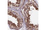Immunohistochemical staining of human testis shows strong cytoplasmic positivity in cells in seminiferous ducts.