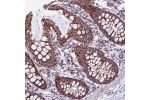 Immunohistochemical staining of human colon shows strong cytoplasmic positivity with granular pattern in glandular cells.