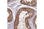 Immunohistochemical staining of human testis shows strong cytoplasmic and nuclear positivity in cells in seminiferus ducts.