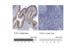 Immunohistochemistry analysis in human gallbladder and lymph node tissues using HPA040376 antibody. Corresponding TOX3 RNA-seq data are presented for the same tissues.