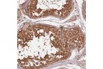 Immunohistochemical staining of human testis shows strong cytoplasmic and nuclear positivity in cells in seminiferus ducts.