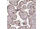 Immunohistochemical staining of human placenta shows moderate cytoplasmic positivity in trophoblastic cells.