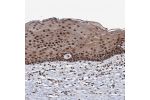 Immunohistochemical staining of human cervix, uterine shows strong nuclear positivity in squamous epithelial cells.