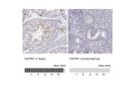 Immunohistochemistry analysis in human testis and endometrium tissues using HPA040421 antibody. Corresponding NUTM1 RNA-seq data are presented for the same tissues.