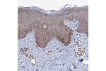 Immunohistochemical staining of human skin shows moderate cytoplasmic positivity in most cell types.