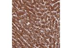 Immunohistochemical staining of human liver shows strong cytoplasmic positivity in hepatocytes.