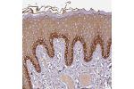 Immunohistochemical staining of human vulva/anal skin shows distinct cytoplasmic positivity in basal layer of epidermis.