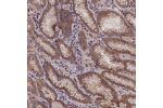 Immunohistochemical staining of human stomach, upper shows moderate cytoplasmic positivity in glandular cells.