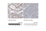Immunohistochemistry analysis in human testis and pancreas tissues using HPA040503 antibody. Corresponding CEP192 RNA-seq data are presented for the same tissues.