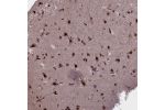 Immunohistochemical staining of human cerebral cortex shows strong nuclear positivity in neuronal cells.