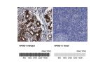 Immunohistochemistry analysis in human breast and colon tissues using Anti-APOD antibody. Corresponding APOD RNA-seq data are presented for the same tissues.
