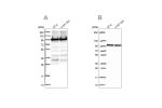 Western blot analysis using Anti-EEF2 antibody HPA040534 (A) shows similar pattern to independent antibody HPA057351 (B).