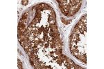 Immunohistochemical staining of human testis shows strong granular cytoplasmic positivity in cells in seminiferous ducts.