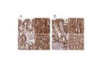 Immunohistochemical staining of human colon, heart muscle, kidney and liver using Anti-ATP5A1 antibody HPA040622 (A) shows similar protein distribution across tissues to independent antibody HPA044202 (B).