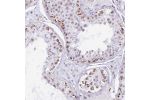 Immunohistochemical staining of human testis shows strong granular cytoplasmic positivity in a subset of cells in seminiferous ducts.