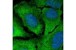 Immunofluorescent staining of human cell line U-2 OS shows localization to plasma membrane & cytosol.