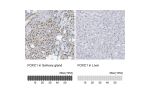 Immunohistochemistry analysis in human salivary gland and liver tissues using Anti-FOXC1 antibody. Corresponding FOXC1 RNA-seq data are presented for the same tissues.