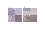 Immunohistochemical staining of human cerebellum, cerebral cortex, gastrointestinal and lymphoid tissues using Anti-EEF1G antibody HPA040688 (A) shows similar protein distribution across tissues to independent antibody HPA055316 (B).
