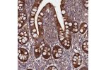 Immunohistochemical staining of human small intestine shows strong cytoplasmic positivity in glandular cells.