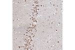 Immunohistochemical staining of human hippocampus shows moderate nuclear positivity in neuronal cells.