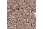 Immunohistochemical staining of human cerebral cortex shows strong granular cytoplasmic positivity in neurons.