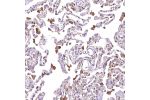 Immunohistochemical staining of human lung shows moderate cytoplasmic positivity in macrophages.
