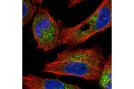 Immunofluorescent staining of human cell line U-251 MG shows localization to endoplasmic reticulum & vesicles.