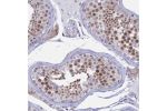 Immunohistochemical staining of human testis shows moderate nuclear positivity in cells in seminiferous ducts.
