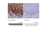 Immunohistochemistry analysis in human stomach and skin tissues using HPA040774 antibody. Corresponding GIF RNA-seq data are presented for the same tissues.