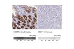 Immunohistochemistry analysis in human small intestine and pancreas tissues using HPA040778 antibody. Corresponding DMBT1 RNA-seq data are presented for the same tissues.